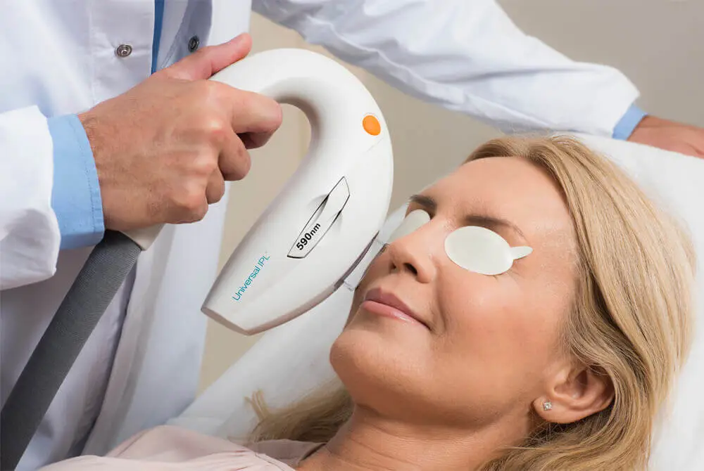 Managing Dry Eye Disease with OptiLight IPL Therapy
