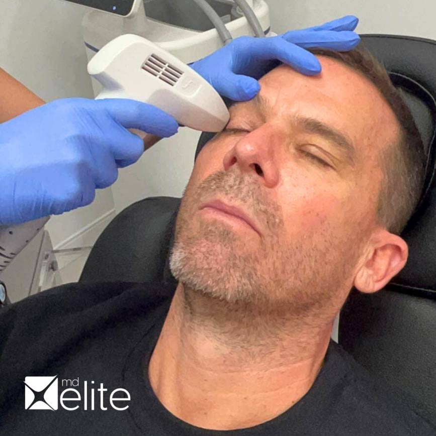 iProElite-Dry-Eye-Treatment_img